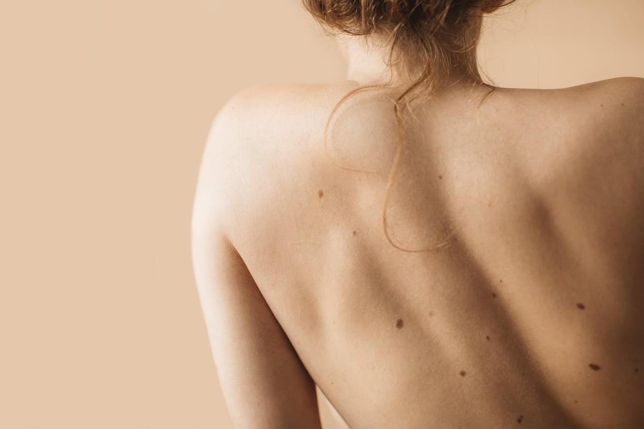 I learned to look at myself naked in the mirror — and now I accept what I see — Lifestyle